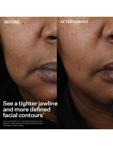 Peptight™ Face Lift Serum TL