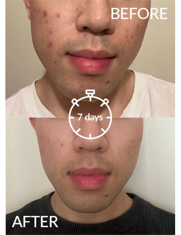 Skintelligence Purifying Serum