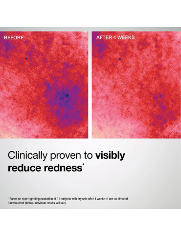 Barrier Restore+ Soothing Ceramide Cream